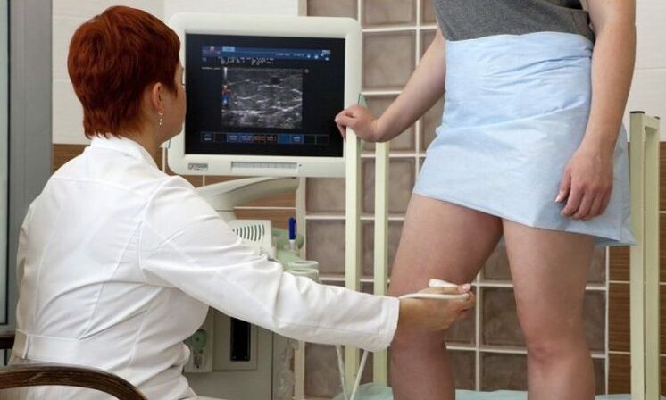 Laserkoagulation zur Behandlung von Krampfadern