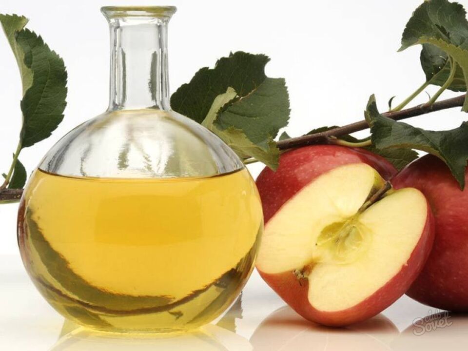 Apfelessig gegen Krampfadern